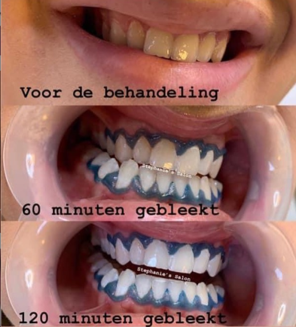 NIEUW! VIP Bleekgel 3ML